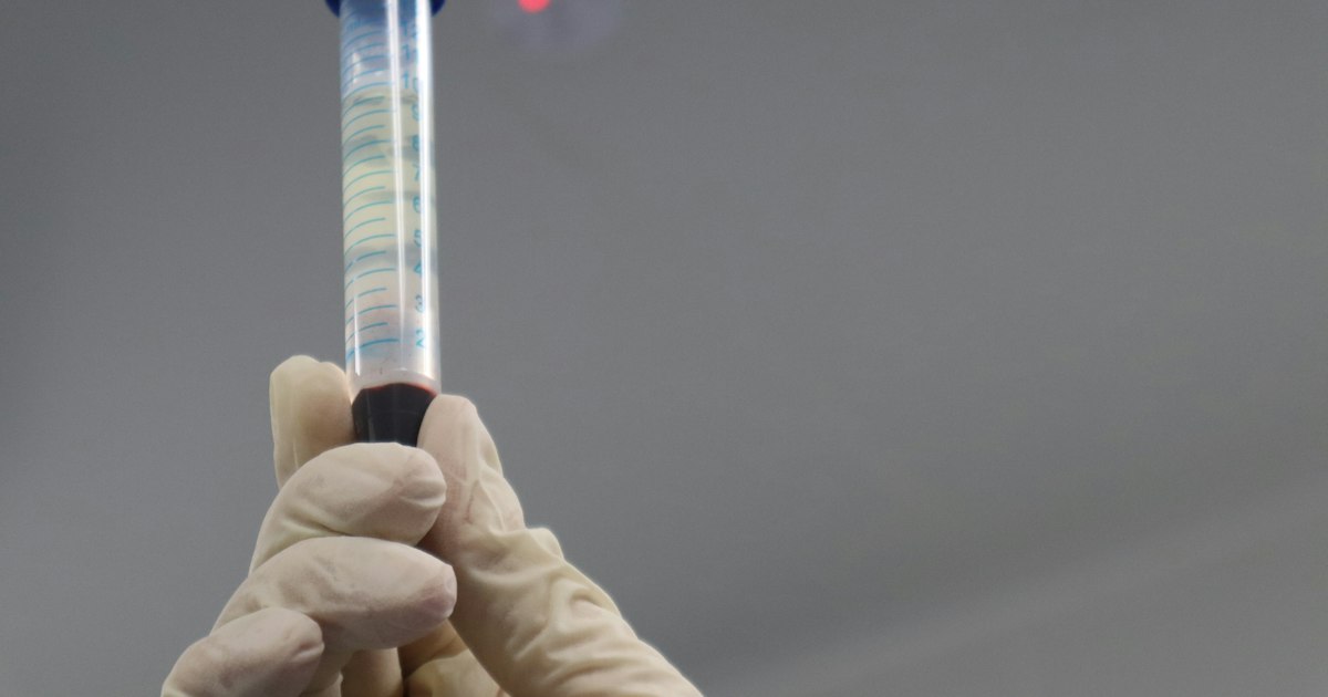 Uric acid: what the test shows and why it matters for an athlete