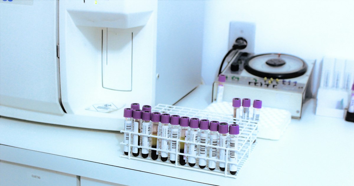 Uric acid above or below normal: causes in athletes and what to do