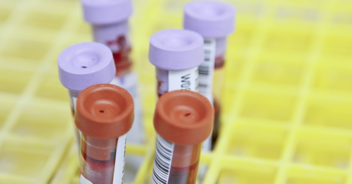 C-reactive protein: what the test shows and why it matters for an athlete